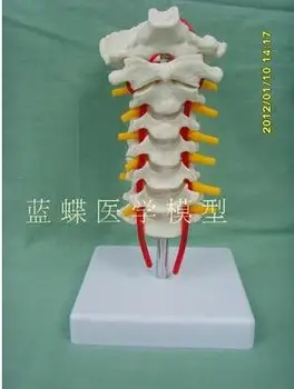 Модель шейного позвонка с сонной артерией, затылочной костью, межпозвоночным диском и нервным окончанием, модель шейного позвонка